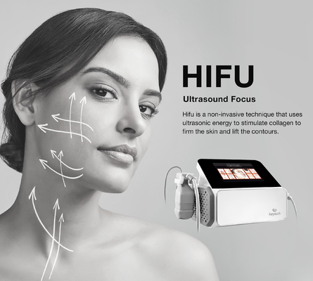 Hiệu ứng điều trị khu vực mục tiêu mắt HIFU trắng